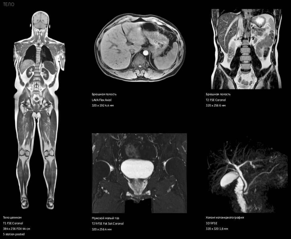 MRI images of the human body | VS Buzaev International MRgFUS Medical Treatment Centre MRI images of the human body