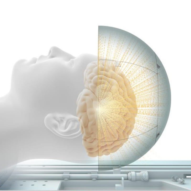 Schematic illustration of how tremor treatment with focused ultrasound works | VS Buzaev International MRgFUS Medical Treatment Centre Schematic illustration of how tremor treatment with focused ultrasound works