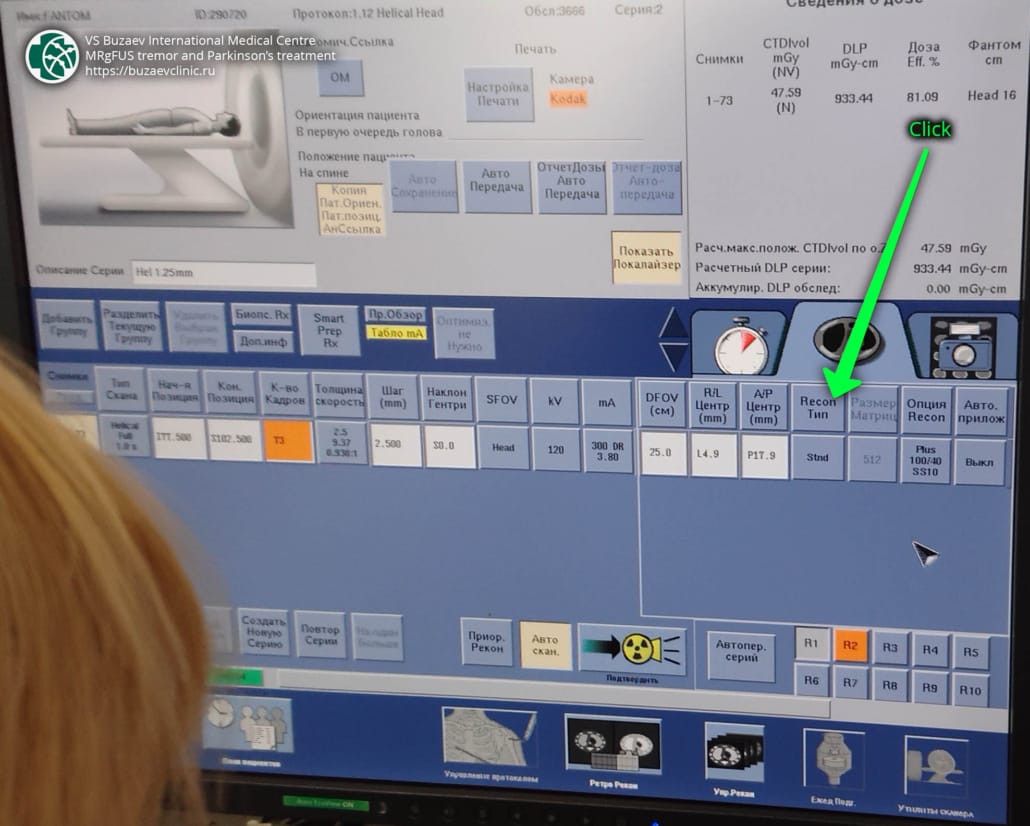 General Electric (GE) CT machine: how to perform CT scan for MRgFUS preplan