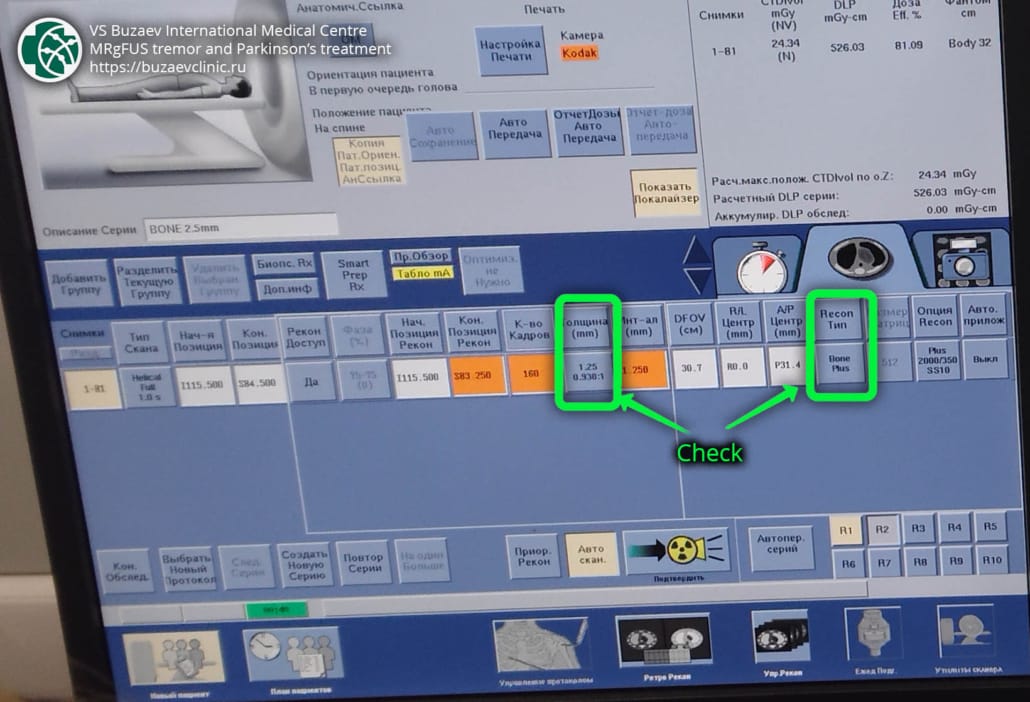 General Electric (GE) CT machine: how to perform CT scan for MRgFUS preplan