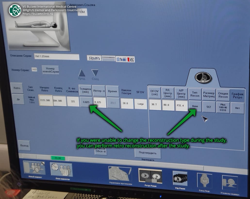General Electric (GE) CT machine: how to perform CT scan for MRgFUS preplan