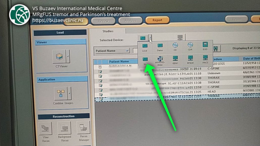 Philips CT machine: how to perform CT scan for MRgFUS preplan?