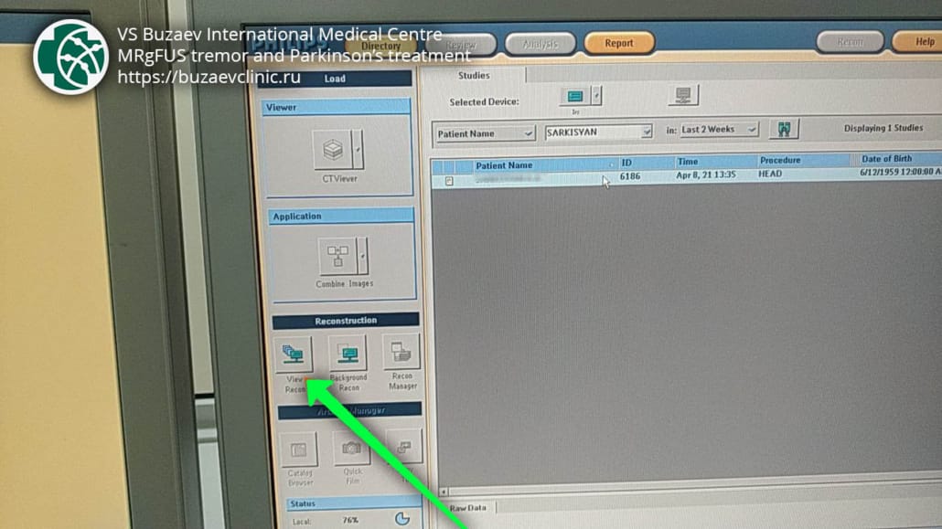 Philips CT machine: how to perform CT scan for MRgFUS preplan?
