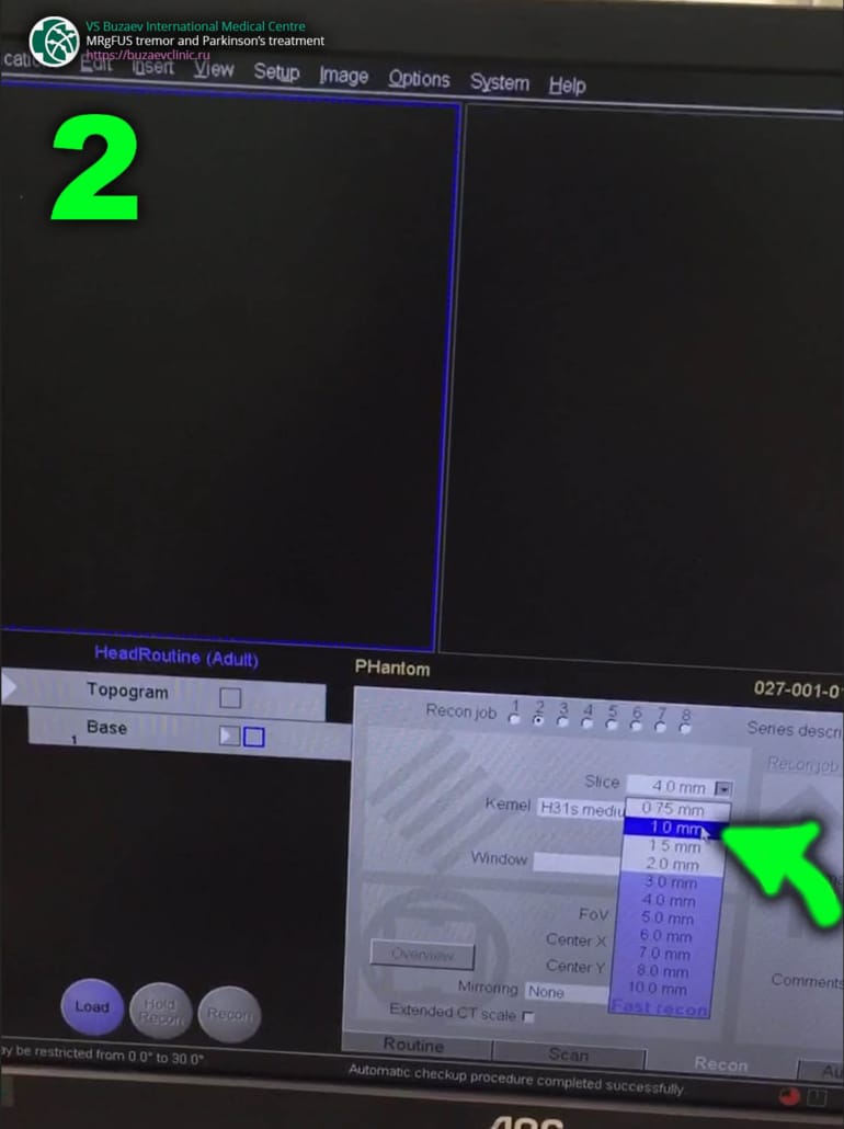 Siemens CT machine: how to perform CT scan for MRgFUS preplan