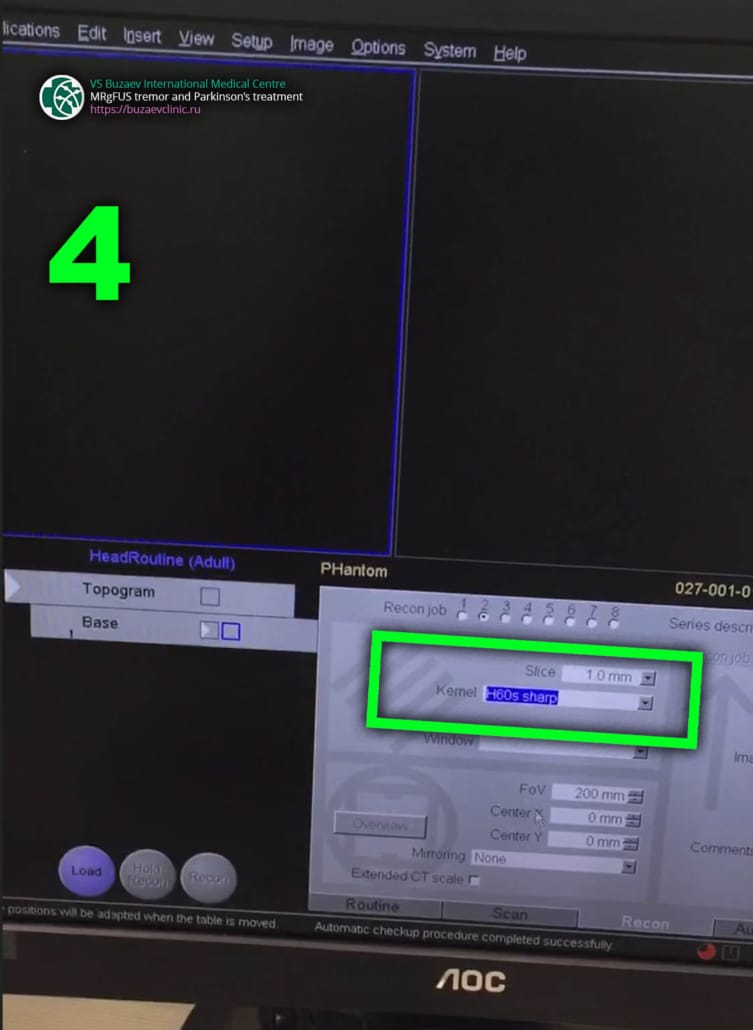 Siemens CT machine: how to perform CT scan for MRgFUS preplan