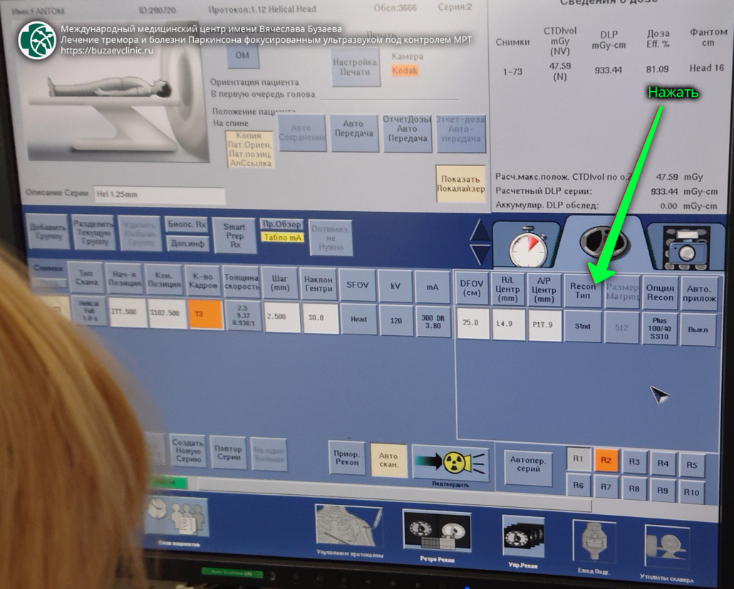 CT protocol for preliminary planning of tremor or Parkinson's disease treatment using MRI-guided focused ultrasound: GE