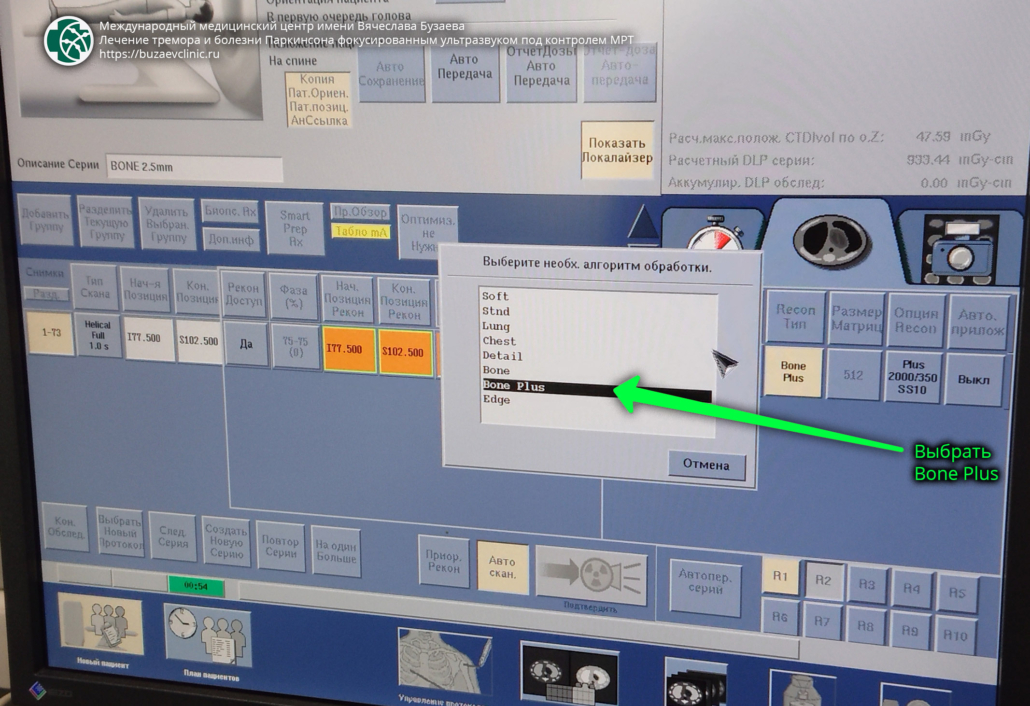 CT protocol for preliminary planning of tremor or Parkinson's disease treatment using MRI-guided focused ultrasound: GE