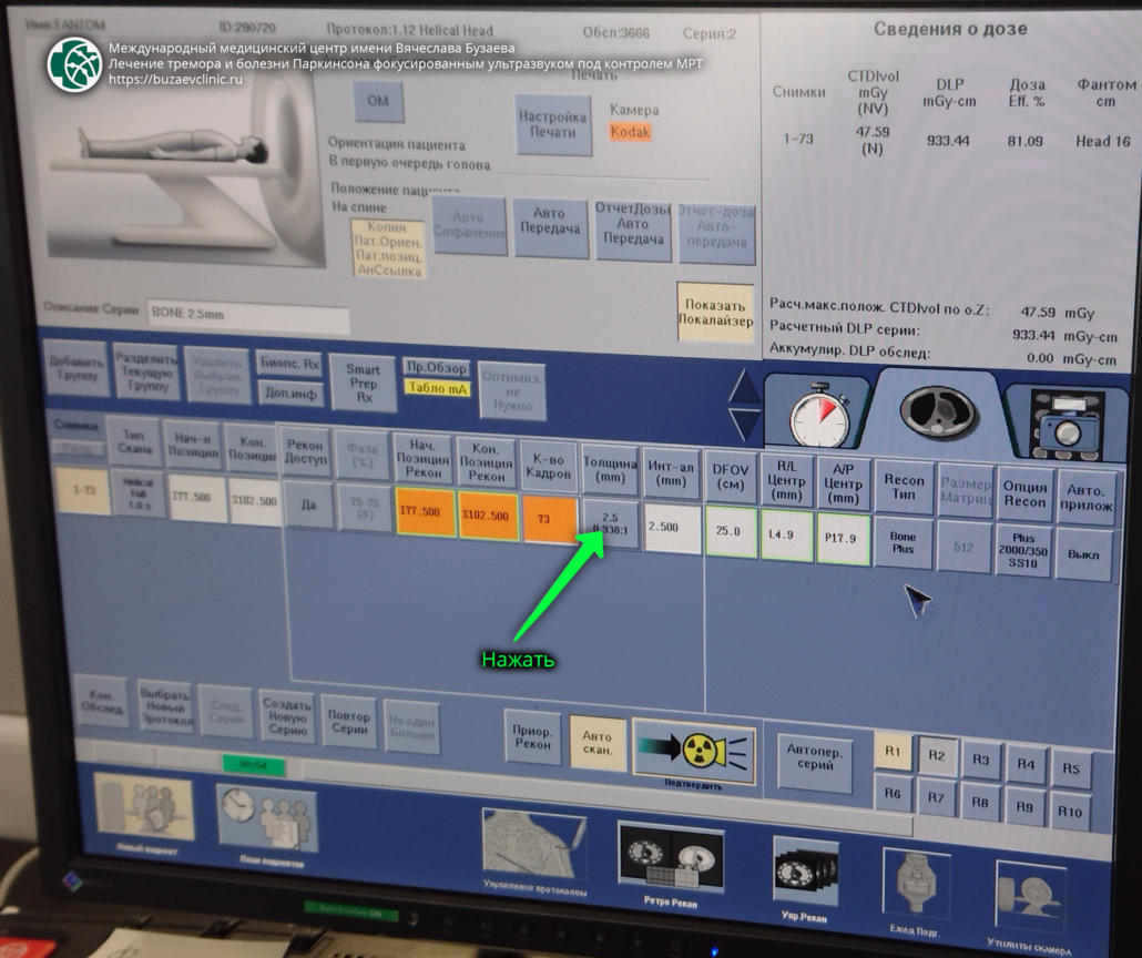 CT protocol for preliminary planning of tremor or Parkinson's disease treatment using MRI-guided focused ultrasound: GE