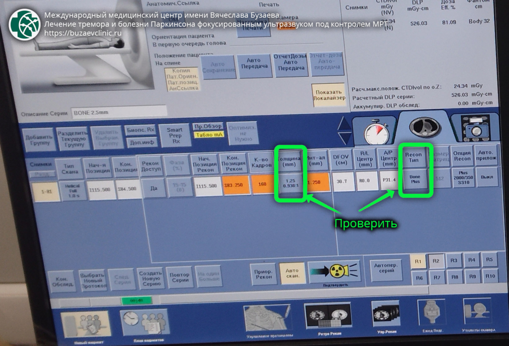 CT protocol for preliminary planning of tremor or Parkinson's disease treatment using MRI-guided focused ultrasound: GE