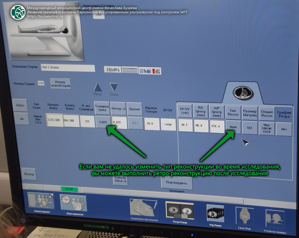CT protocol for preliminary planning of tremor or Parkinson's disease treatment using MRI-guided focused ultrasound: GE