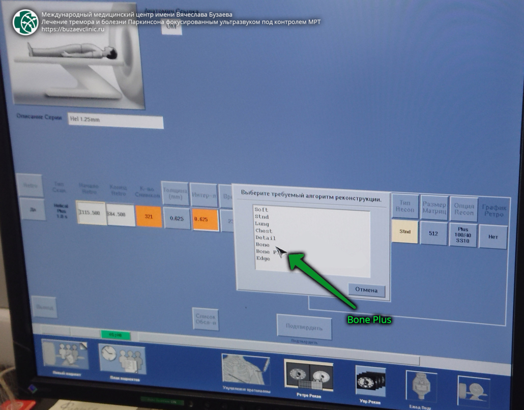 CT protocol for preliminary planning of tremor or Parkinson's disease treatment using MRI-guided focused ultrasound: GE