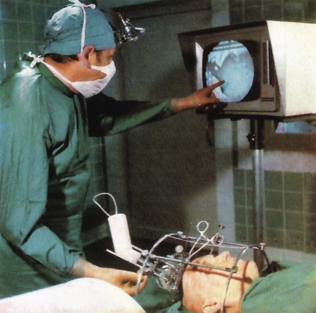 Operated by Professor E.I. Kandel: visual control of the stereotactic brain intervention on the screen of the electro-optical converter 