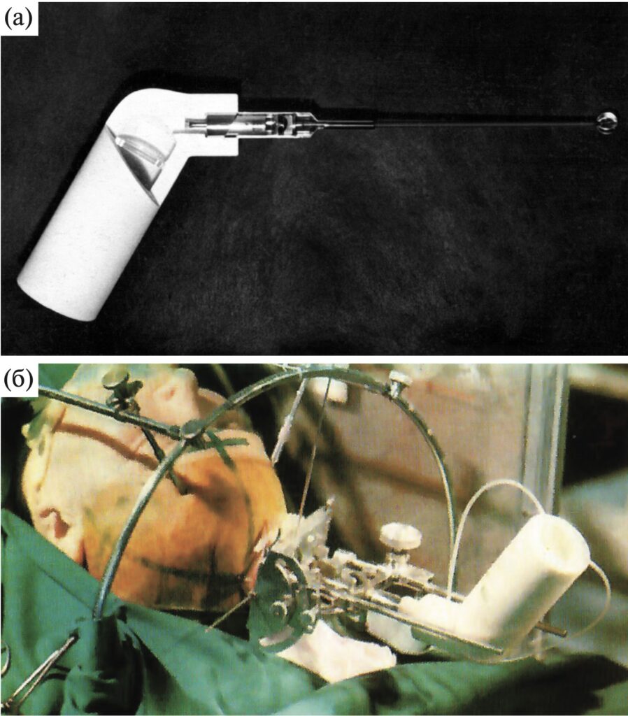Cryosurgical device. a – internal structure. b – the cannula of the cryosurgical device is inserted using a stereotactic apparatus into the specified subcortical structure (moment of surgery before the start of local freezing) 